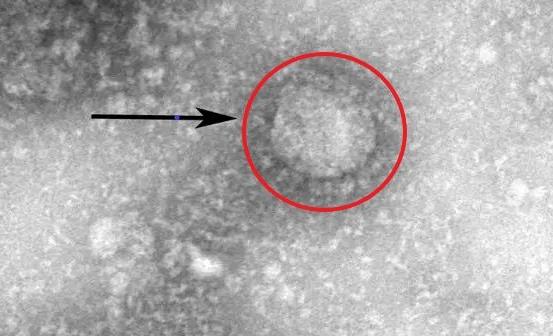 预防新冠病毒忌口有四 家里勤消毒助力抗疫早日成功(图2)